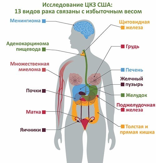 Ожирение 2.jpg